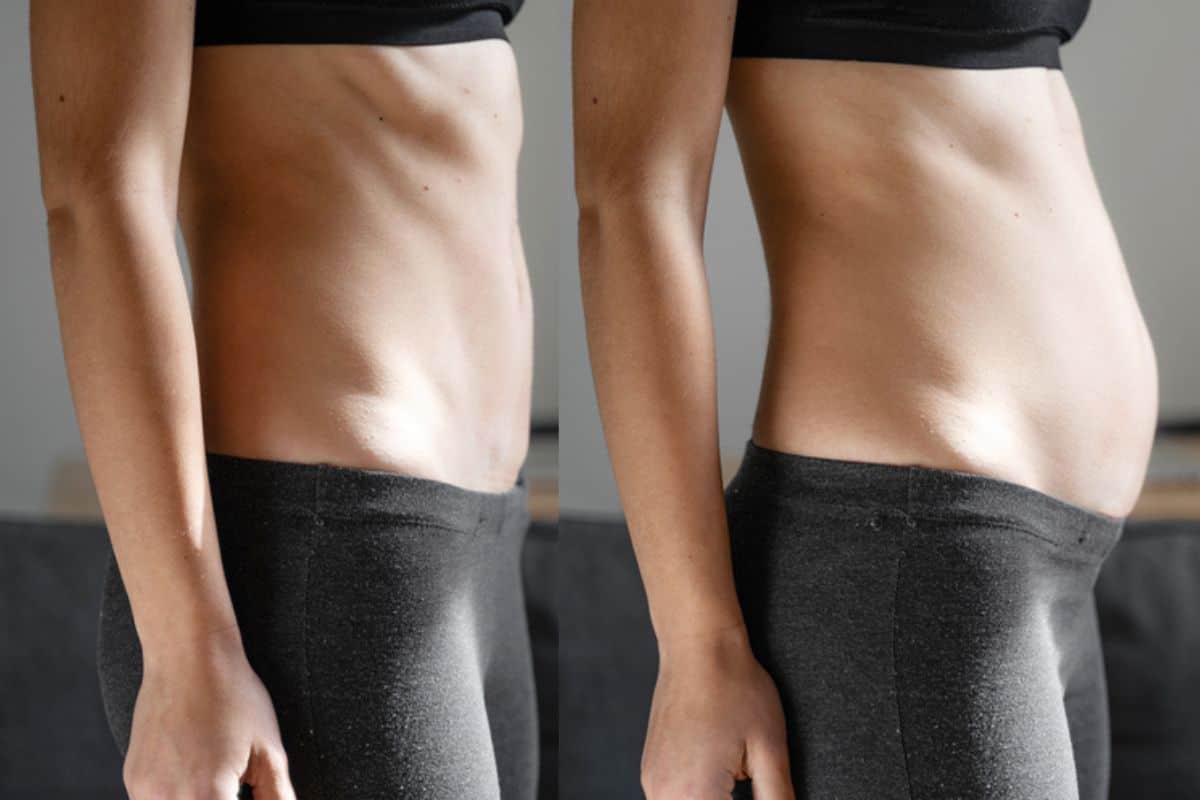 How long does diastasis recti take to improve Brownhills?