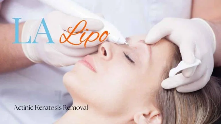 Woman receiving Actinic Keratosis Removal Treatment Brownhills