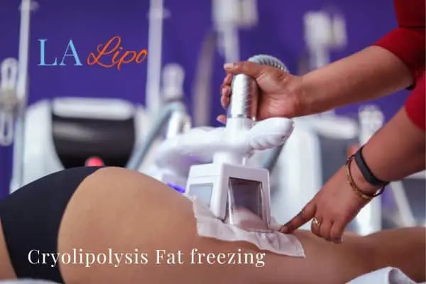 women getting fat freezing Brownhills