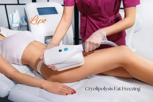 Woman receiving coolsculpting Brownhills treatment on her thighs
