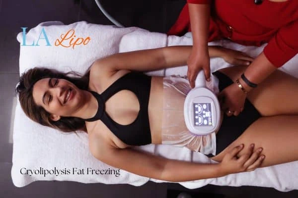 woman getting cryolipolysis Brownhills