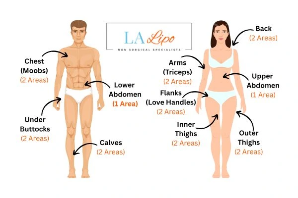 LA LIPO Cryolipolysis Areas Brownhills
