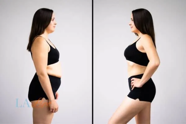 link between body image and mental health Brownhills