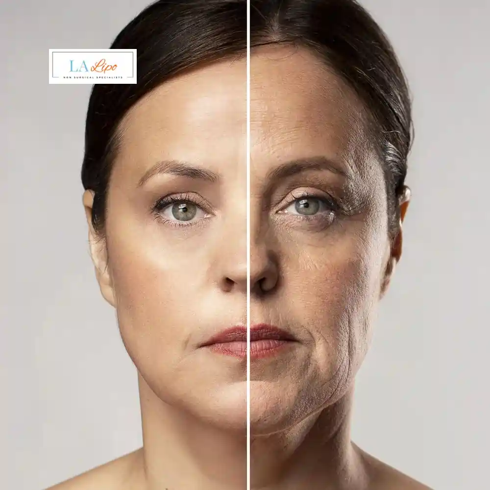 How Can You Tell If Non-Surgical Skin Tightening Is Right for You Brownhills?