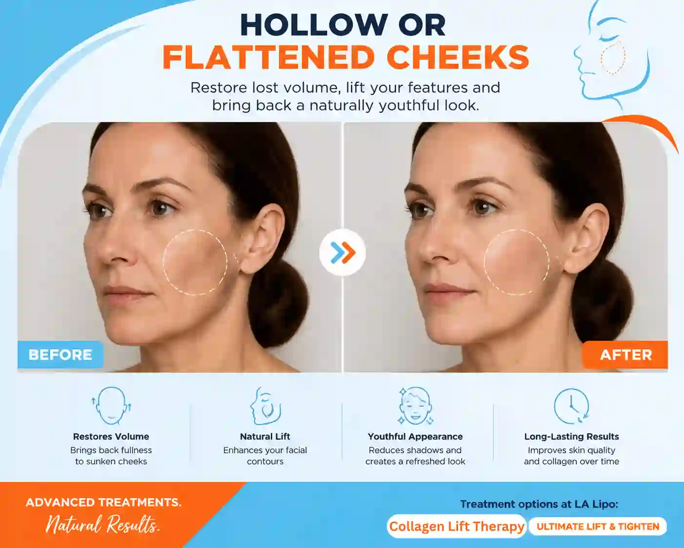 Sign #4: Hollow or Flattened Cheeks Brownhills