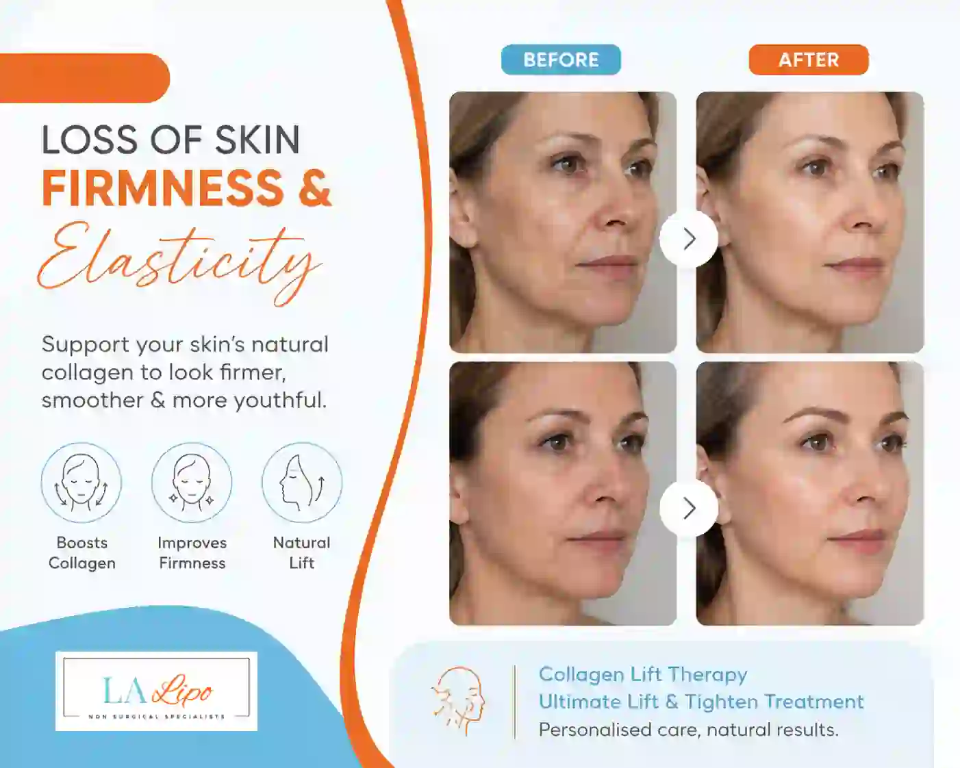 Sign #7: Loss of Skin Firmness and Elasticity Brownhills